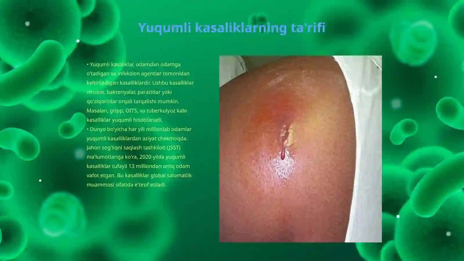 Yuqumli kasaliklar 3