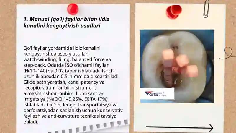 Ildiz kanallarini kengaytirish usullari 3