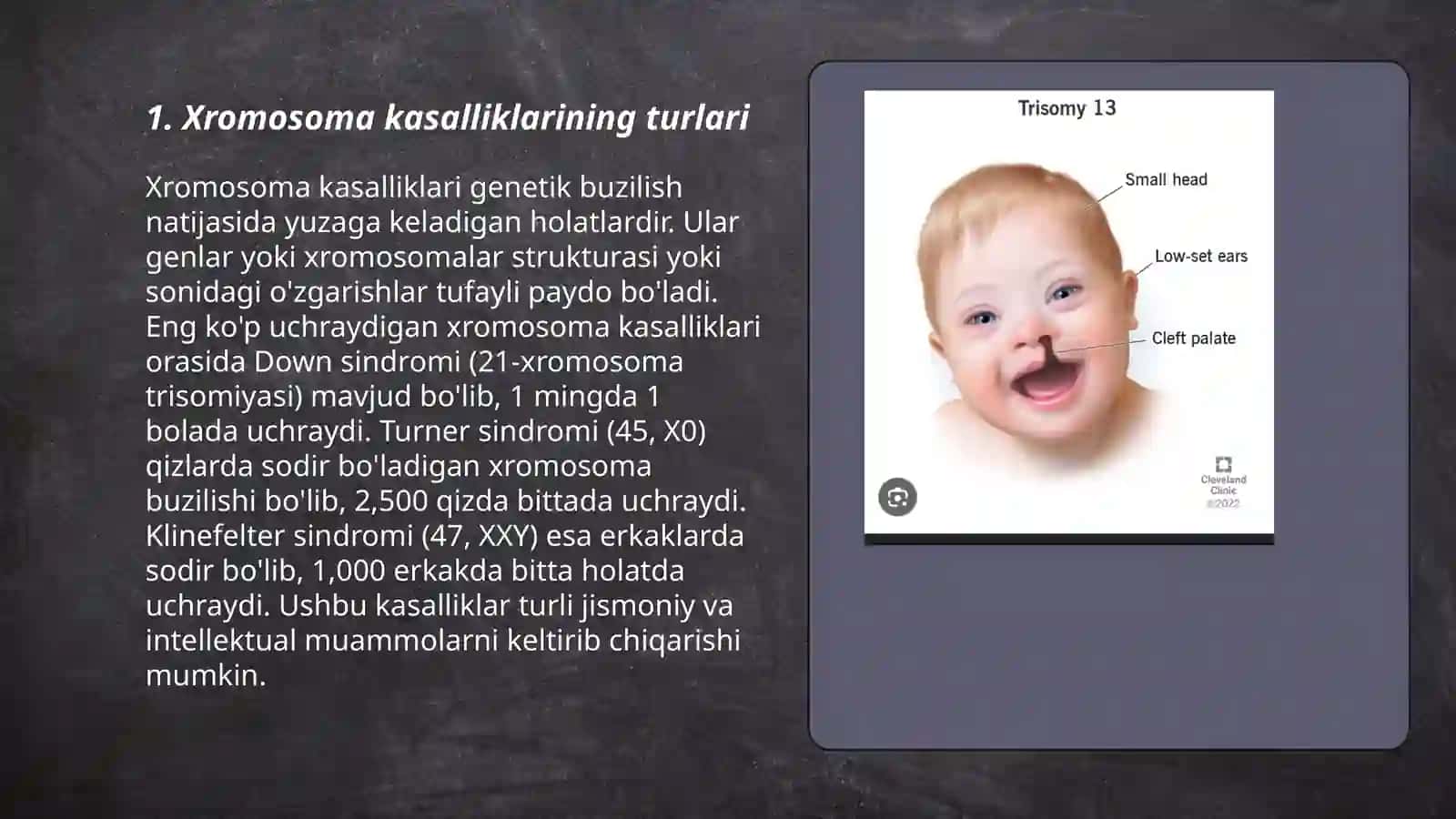 Xromosoma kasalliklari 3