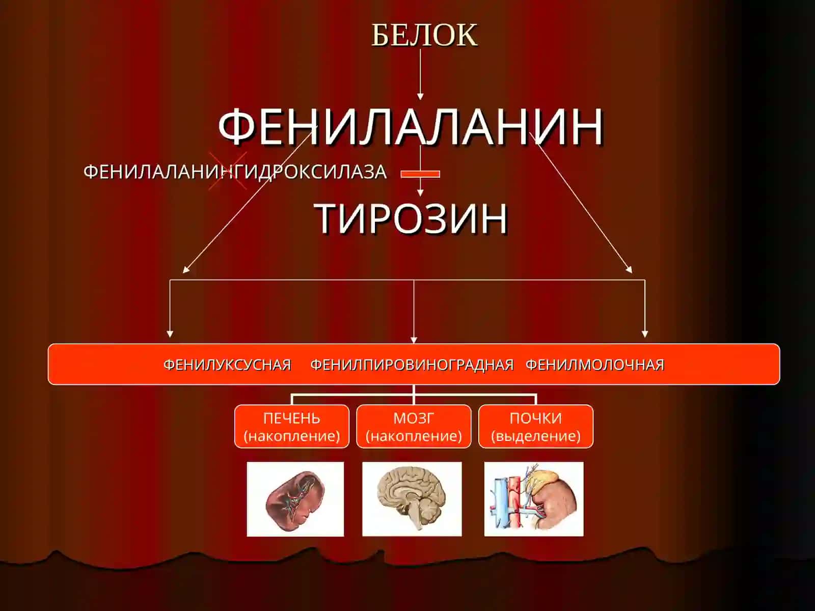 Моногенные заболевания 3