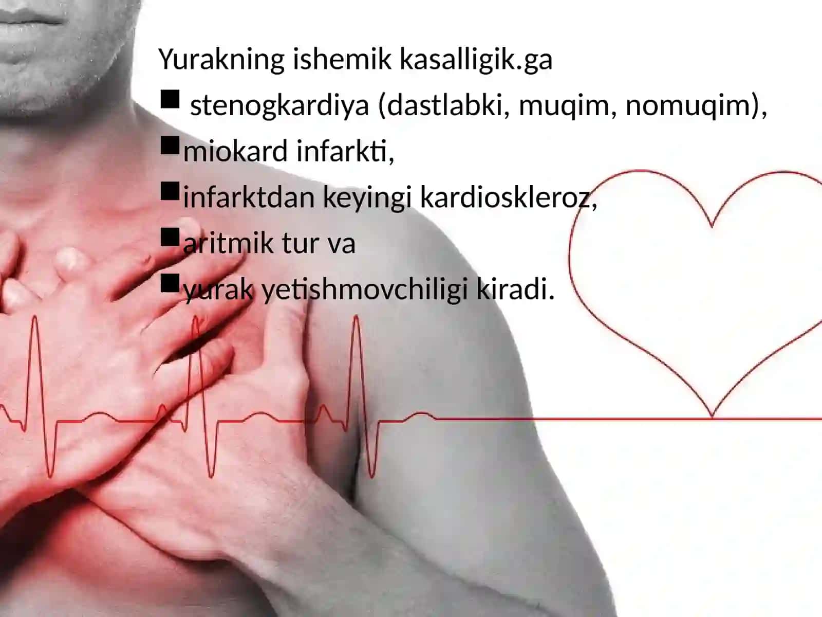 Yurakning ishemik kasalligi (Yurak ishemik kasalliklari) 3