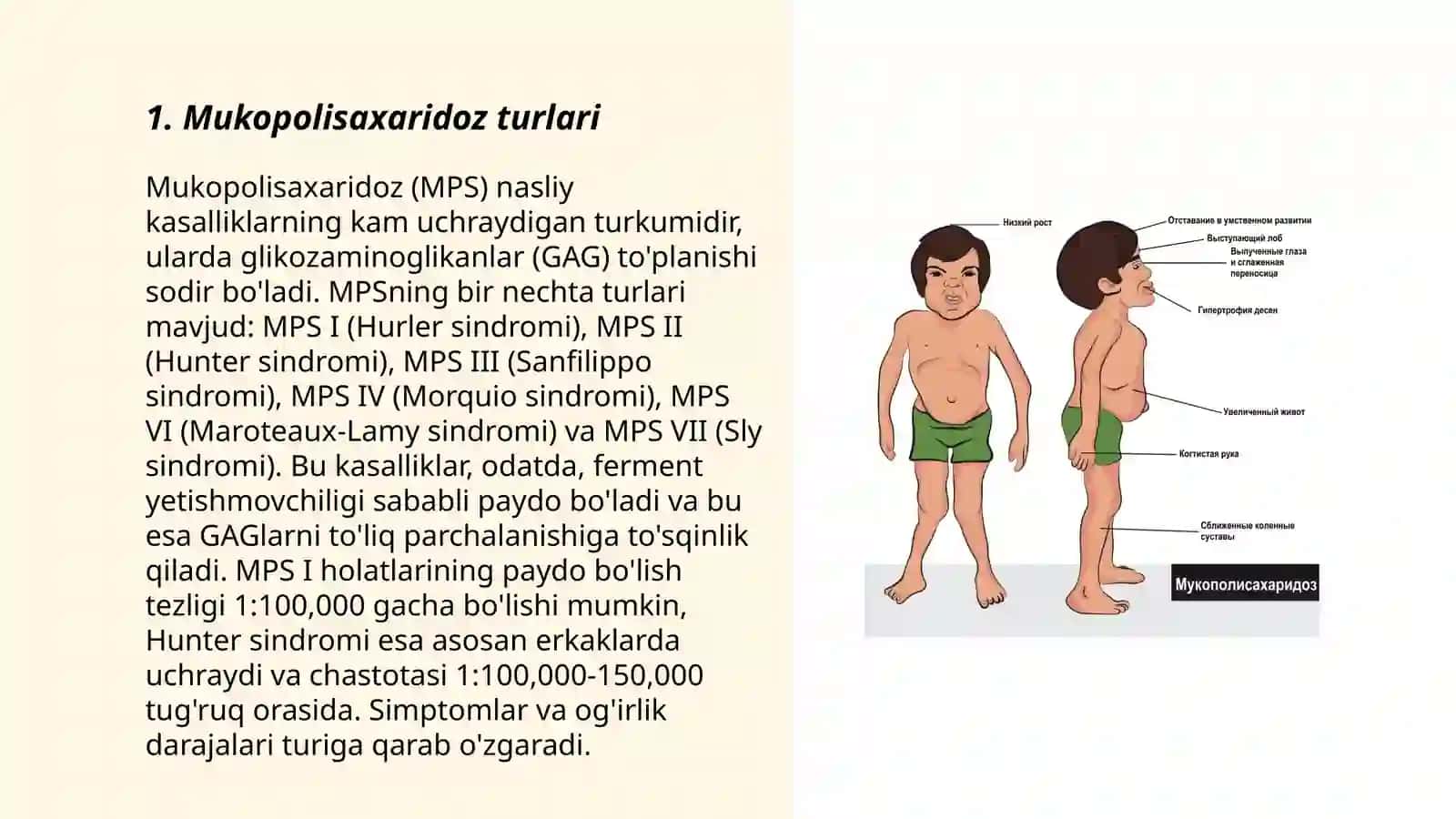 Mukopolisaxaridoz kasalligi 3