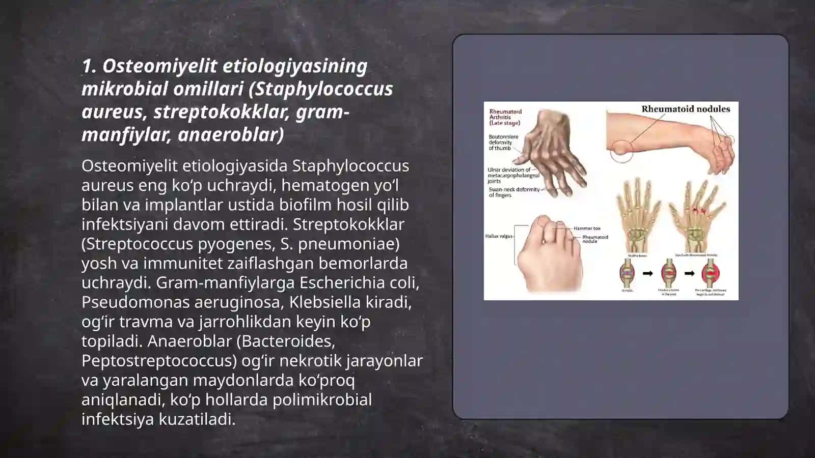 Osteomiyelit va yiringli artrit: etiologiyasi, patogenezi Kaft flegmonasi, panaritsiy etiologiyasi va patogenezi 3