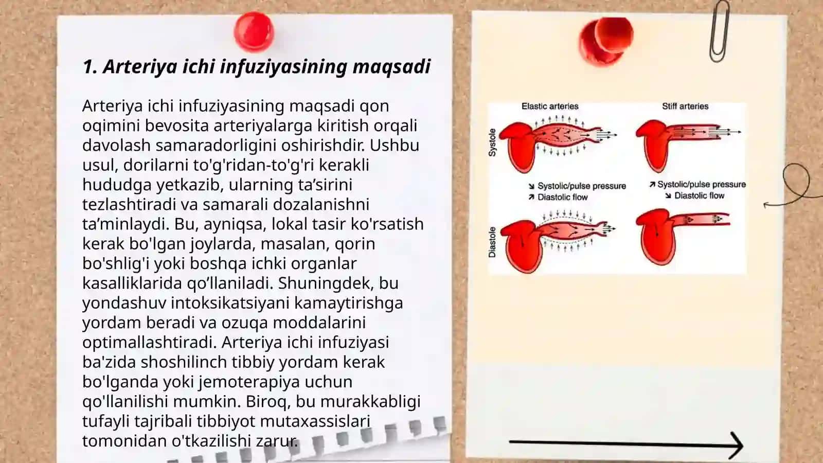 Arteriya ichi infuziyasi 3