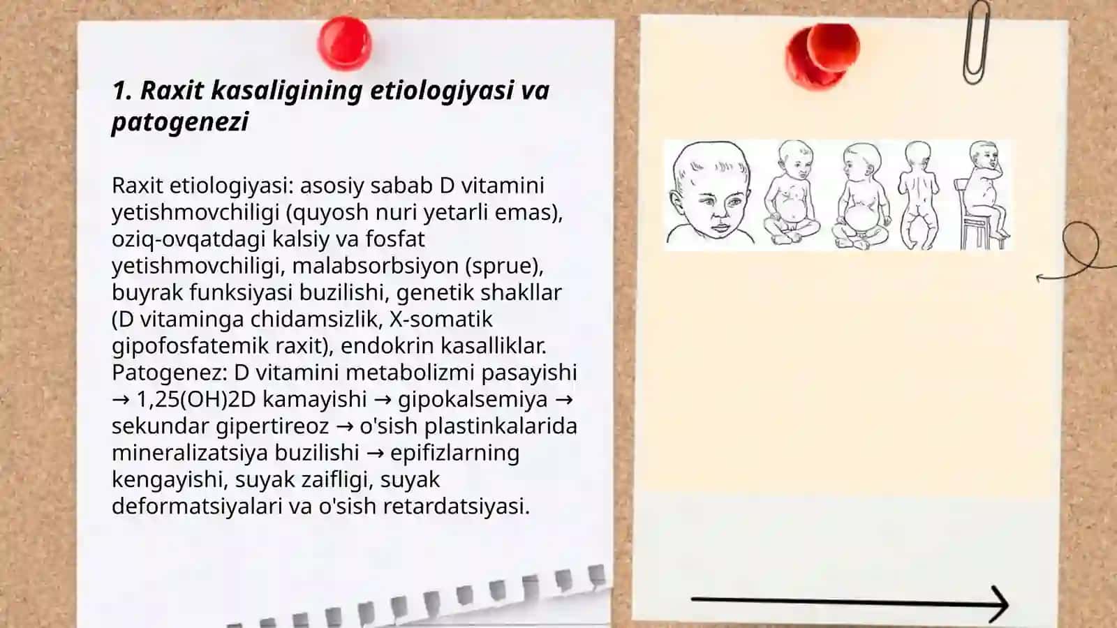 Raxit kasaligi 3