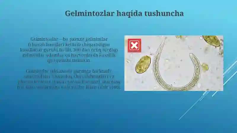 Gelmintozlar 3