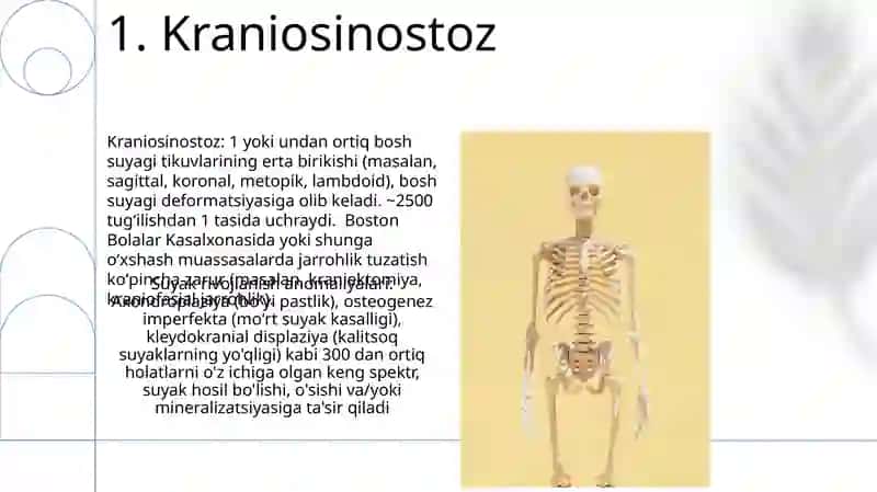Skeletning rivojlanish anomaliyalari 3