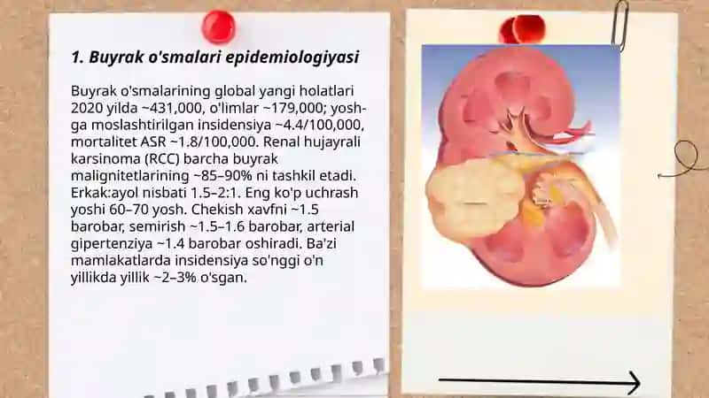 Buyrak o'smalari epidemiologiyasi 3