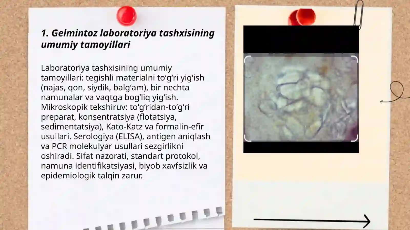 Gelmintoz labarator tashxisi 3