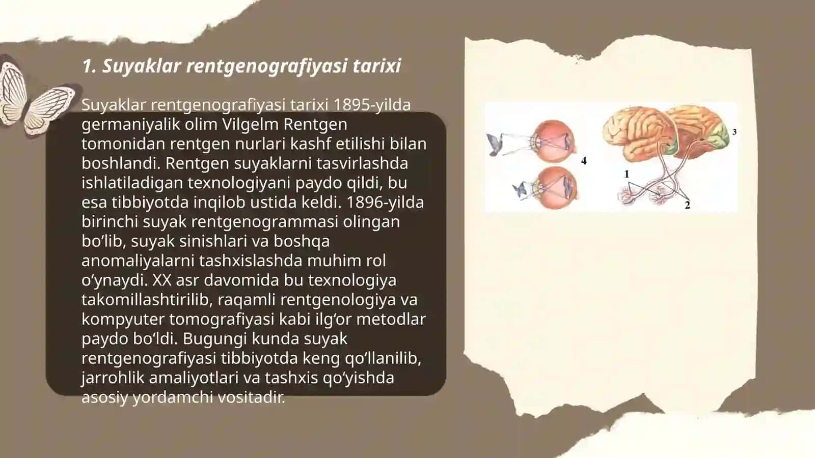 Suyaklar rentgenografiyasi 3