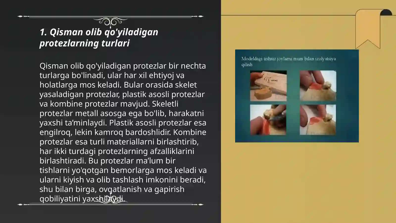Qisman olib qóyiluvchi protezlar 3
