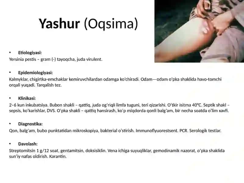 O‘ta hafli infeksiyalar 3