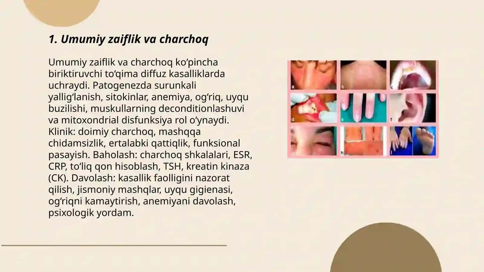 Umumiy zaiflik va charchoq 3