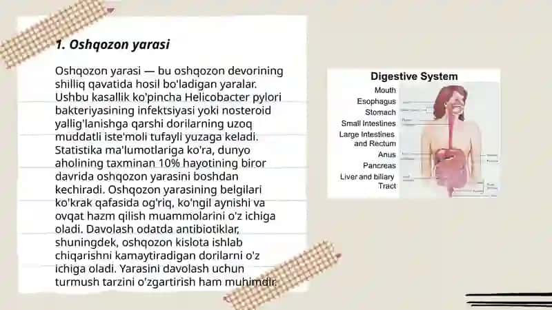 Oshqozon yarasi 3