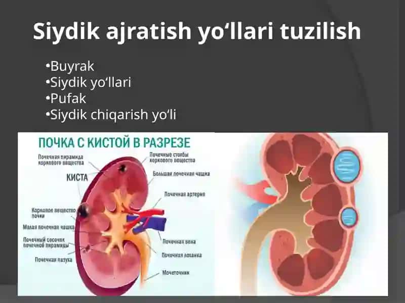qandli diabet sabablari 3