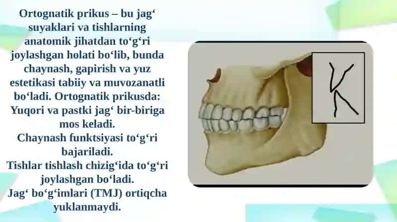 Ochiq prikus muammosi 3