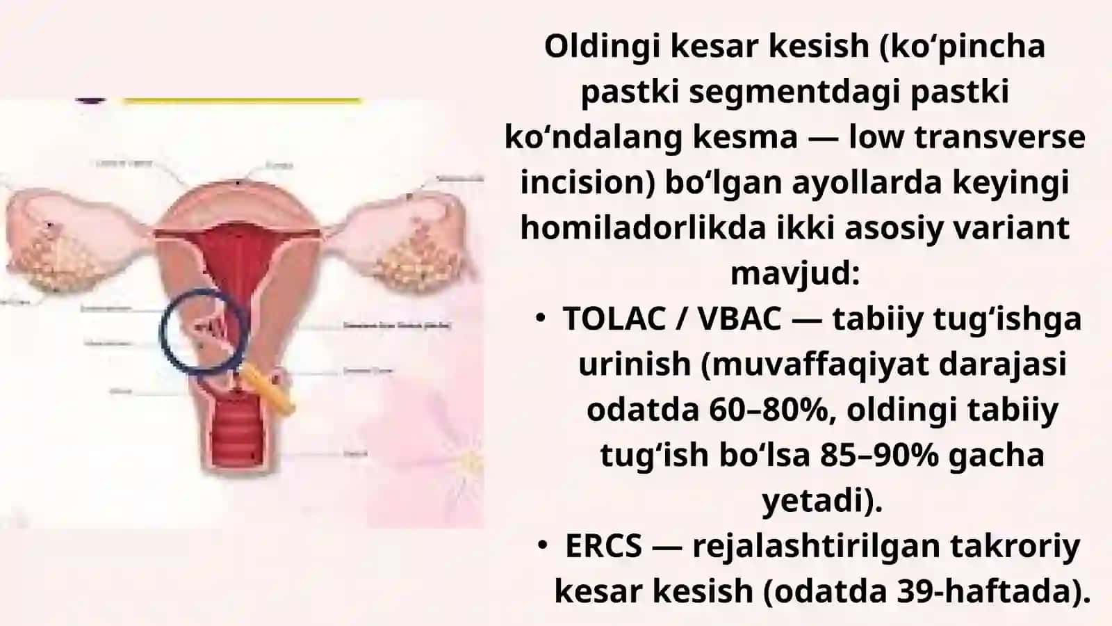 Bachadon chandigʻi bilan homiladorlikni olib borish 3