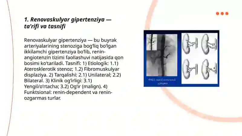 Renovaskulyar gipertenziya 3