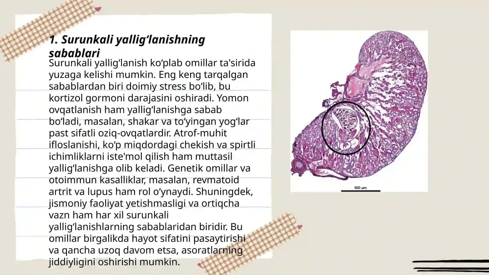 Surunkali yallig‘lanish 3