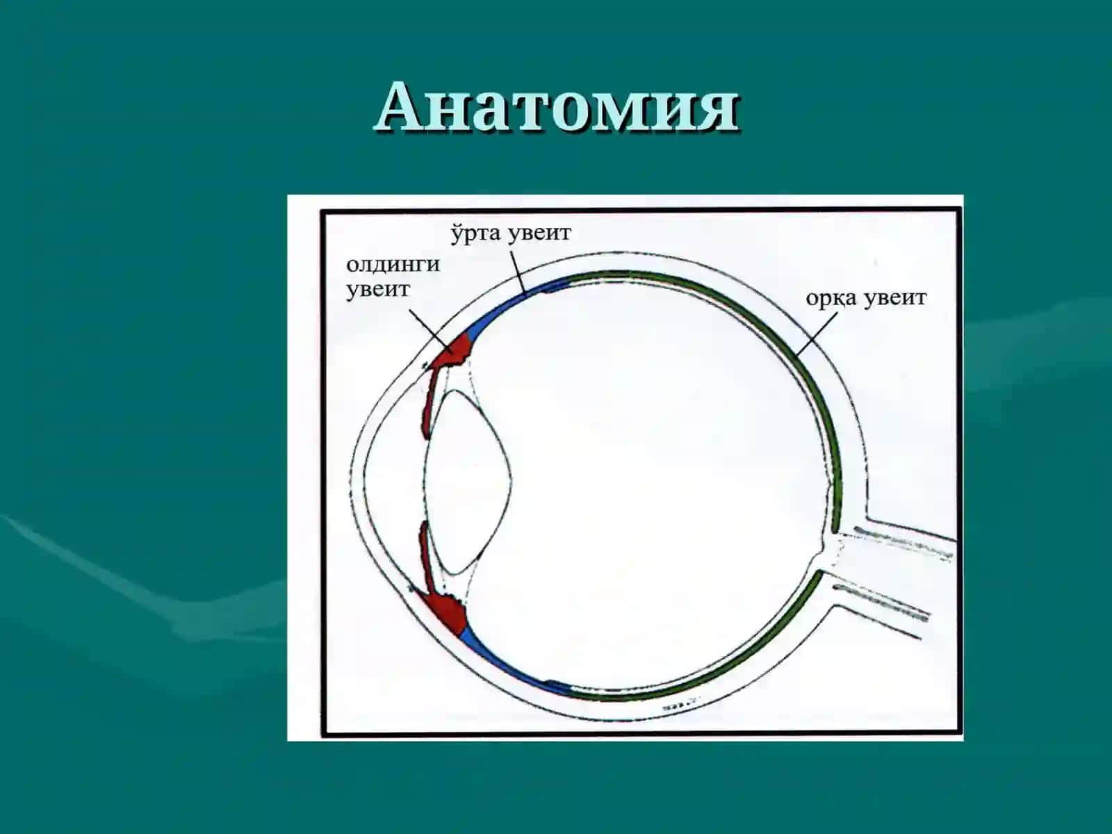 УВЕИТЫ 3