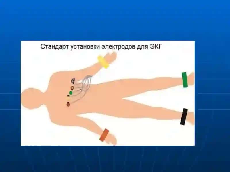 ЭКГ аппарати 3