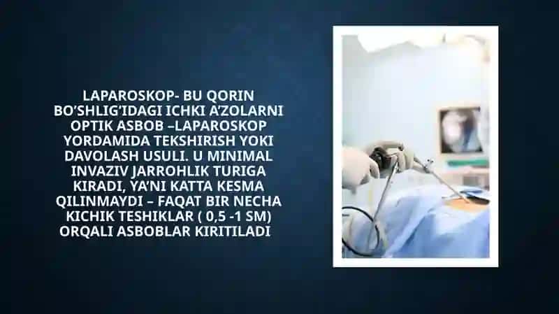Laparaskopiyaning jarrohlikda qo’llanilishi 3