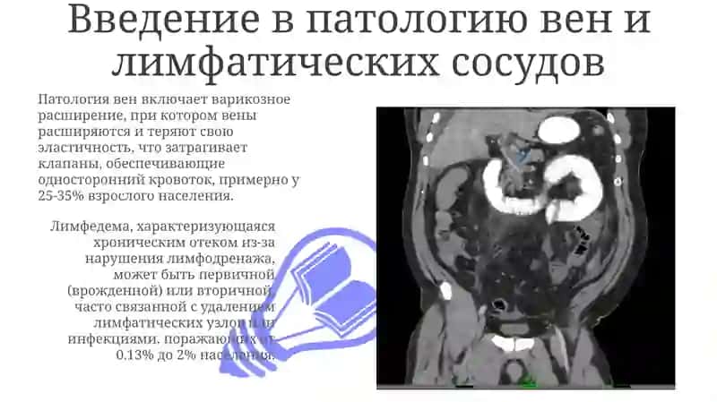 Патология вен и лимфатических сосудов 3
