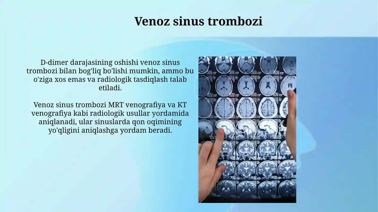 Serebrovaskulyar kasalliklar: radiologiyasi 3