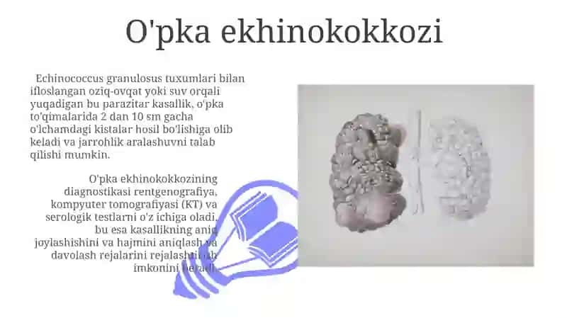 O'pka Ekxinokokkozi 3