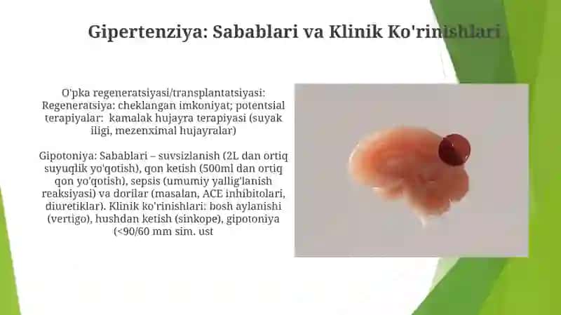 Havo qon tôsiğining tuzilishi vazifalari va patologiyasi.ôpka regeneratsiyasi va transplantatsiyasi 3