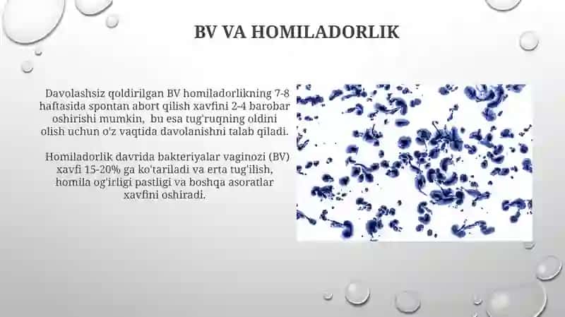 Bakterial vaginoz 3