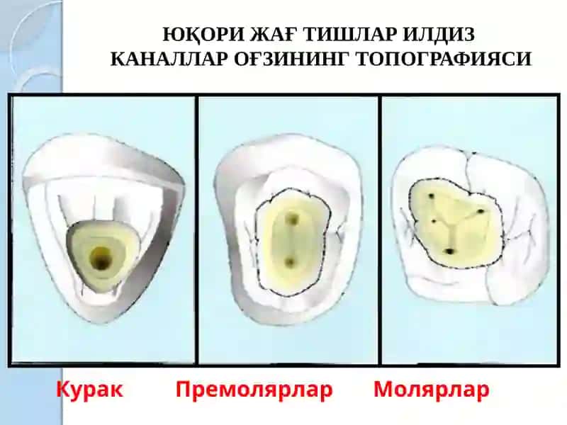 Илдиз каналларини тозалаш ва шакллантириш 3