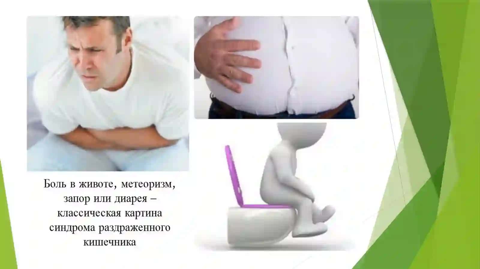 Ichakda`sirlanishsindrominidavolashaspektlari 3