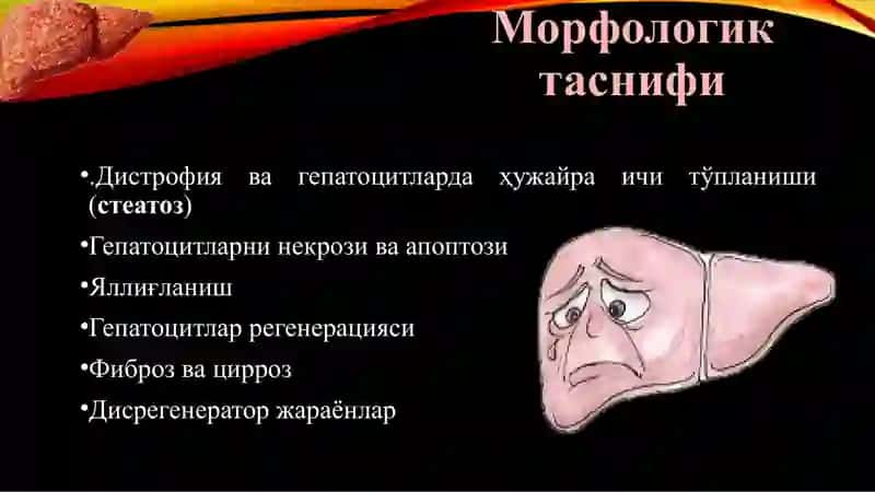 ГепатозГепатитВирусли гепатит 3