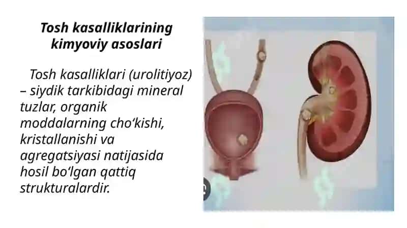 TOSH KASALLIKLARI KIMYOVIY ASOSLARI 3