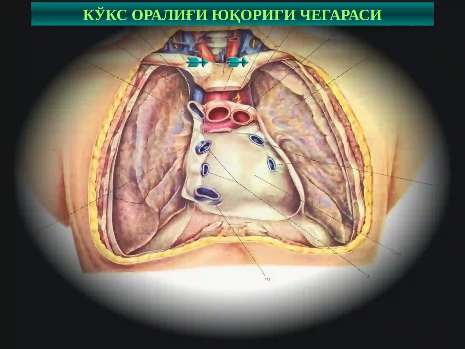 Кўкс оралиғи ва диафрагма касалликлари 3
