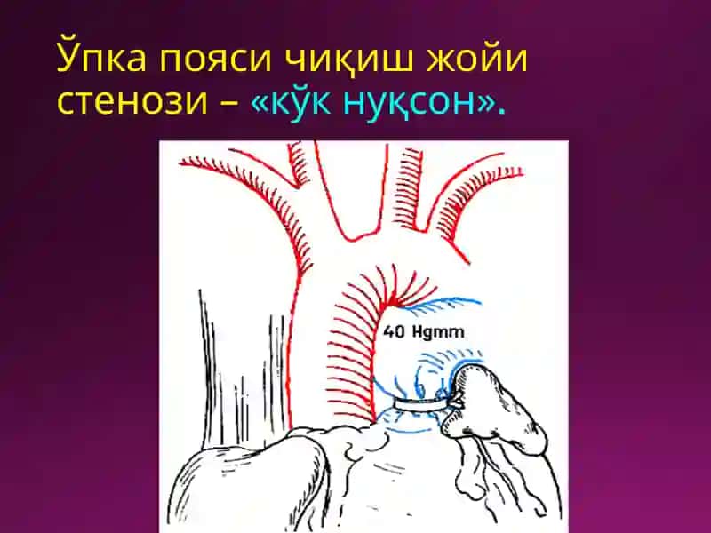 Laparotomiyaturlari 3