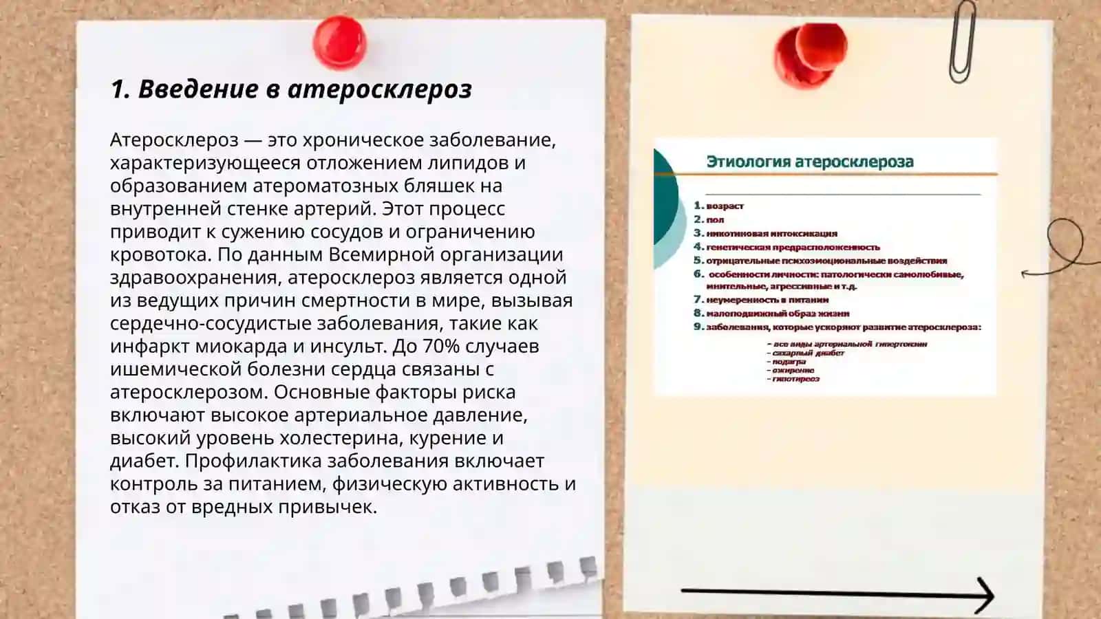 Атеросклероз 3