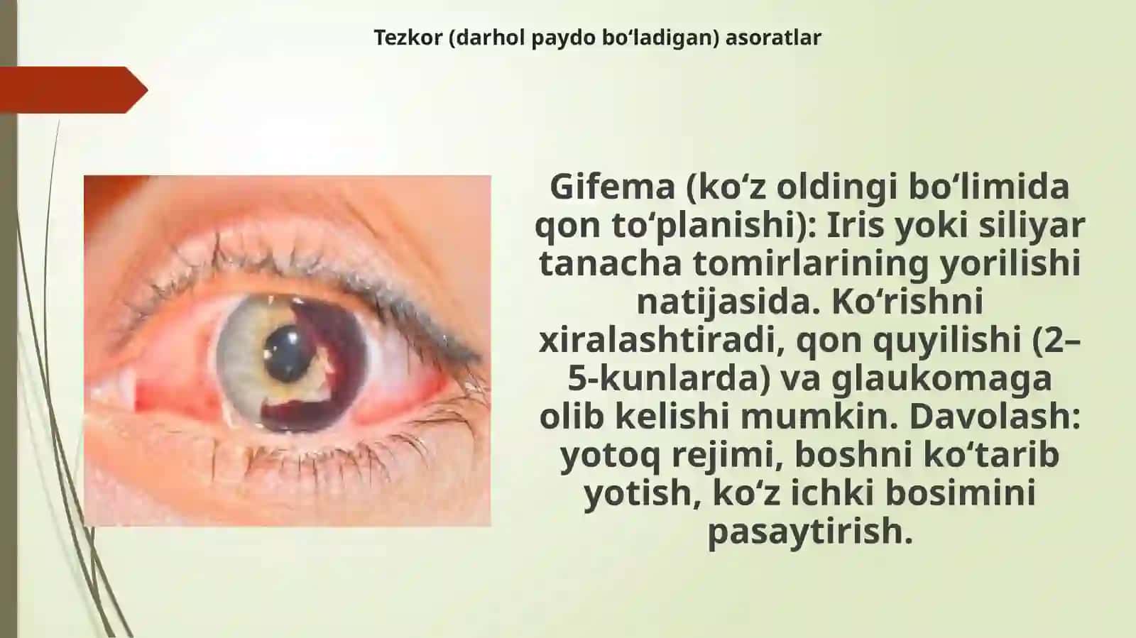 KO’Z TRAVMALARIDA ASORATLAR 3
