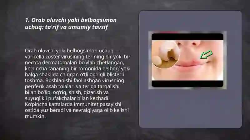 Orab oluvchi yoki belbogsimon uchuq 3
