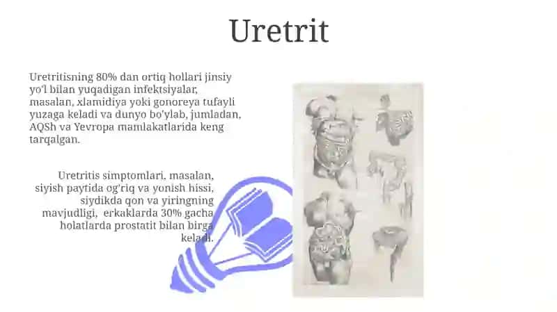 Siydik tanosil tizimi kasalliklari 3