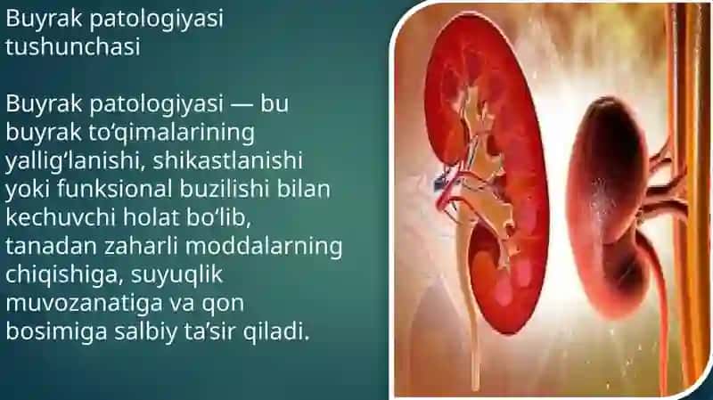 buyrak patalogiyasi 3