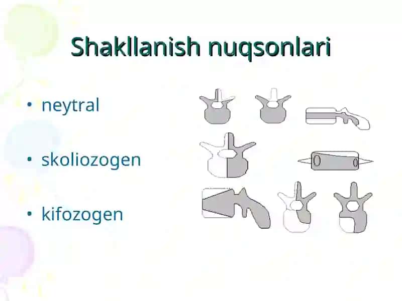 Umurtqaning rivojlanish nuqsonlari 3