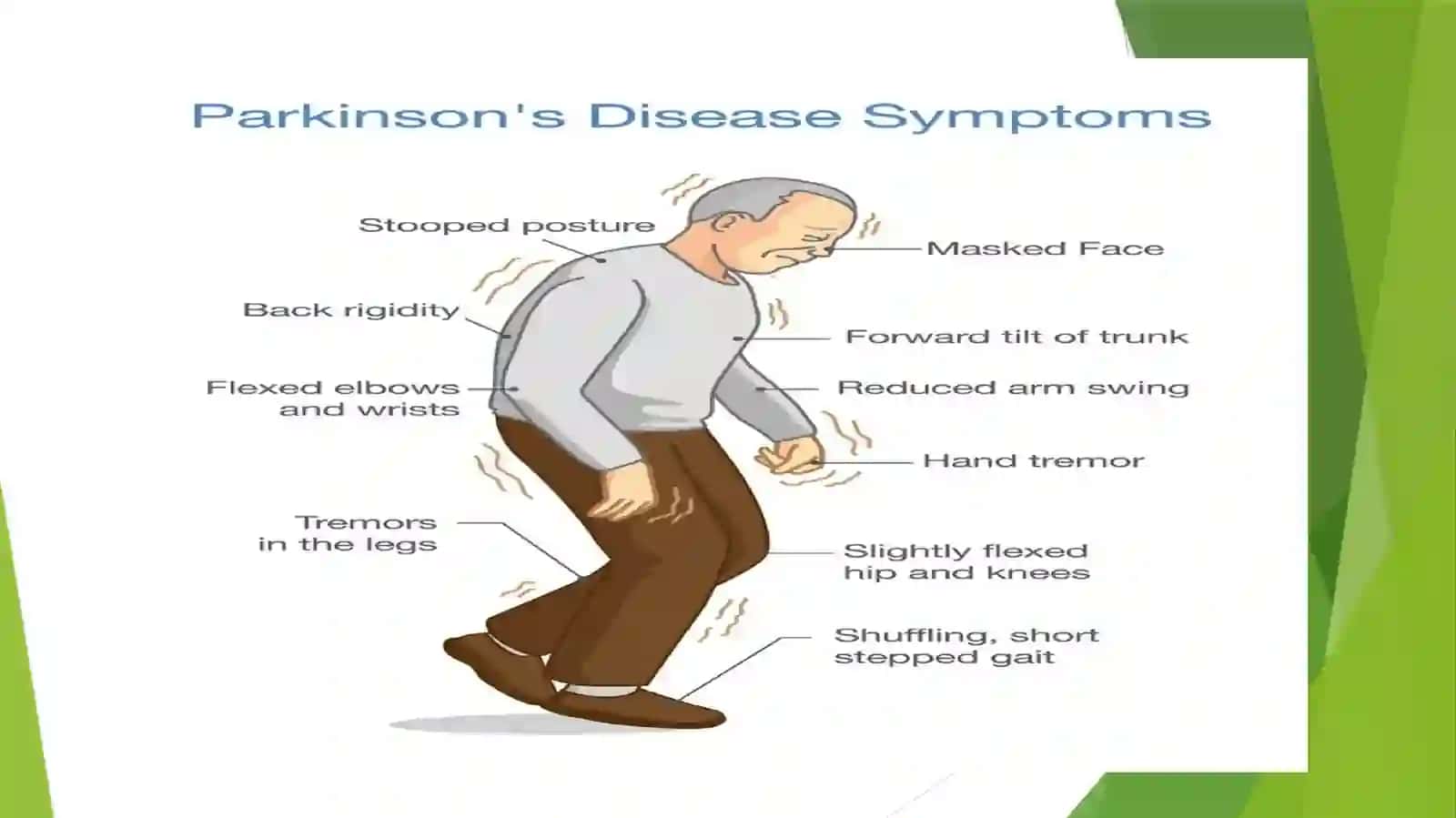 Parkinson kasalliginidavolashda ishlatiladigan dorivorsitalari 3