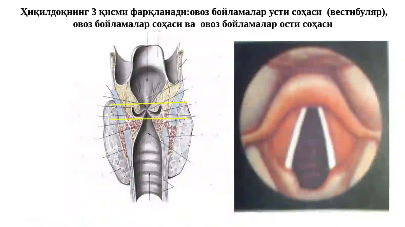 ҲИҚИЛДОҚРАКИ- ЭТИОПАТОГЕНЕЗ, ДИАГНОСТИКА ВА ДАВОЛАШ УСУЛЛАРИ 3