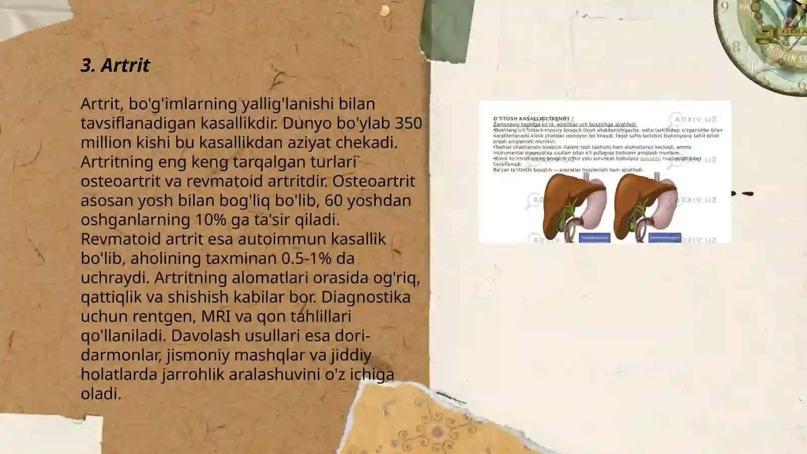 Artrit 3