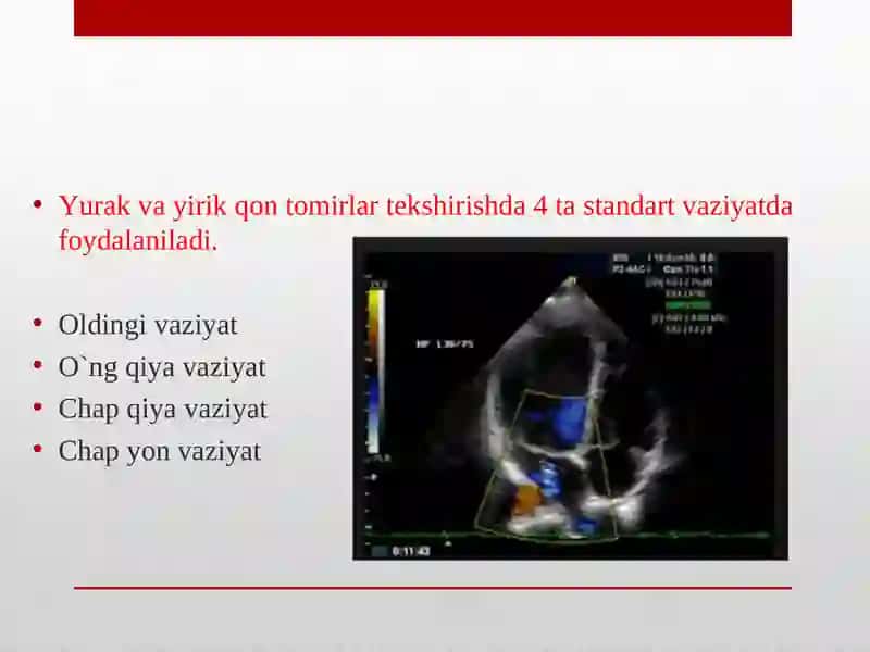 Nur diagnostikasi vaterapiyasi 3