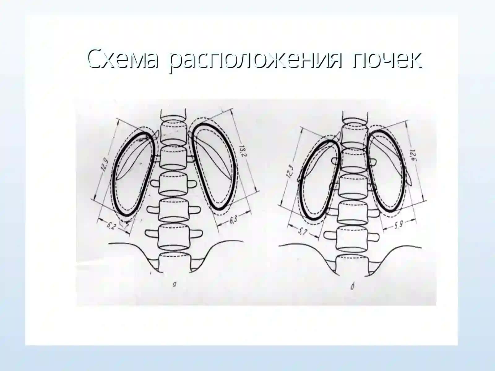 Рентгенологик усуллар 3