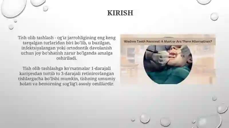 Tisholish operatsiyalari 3