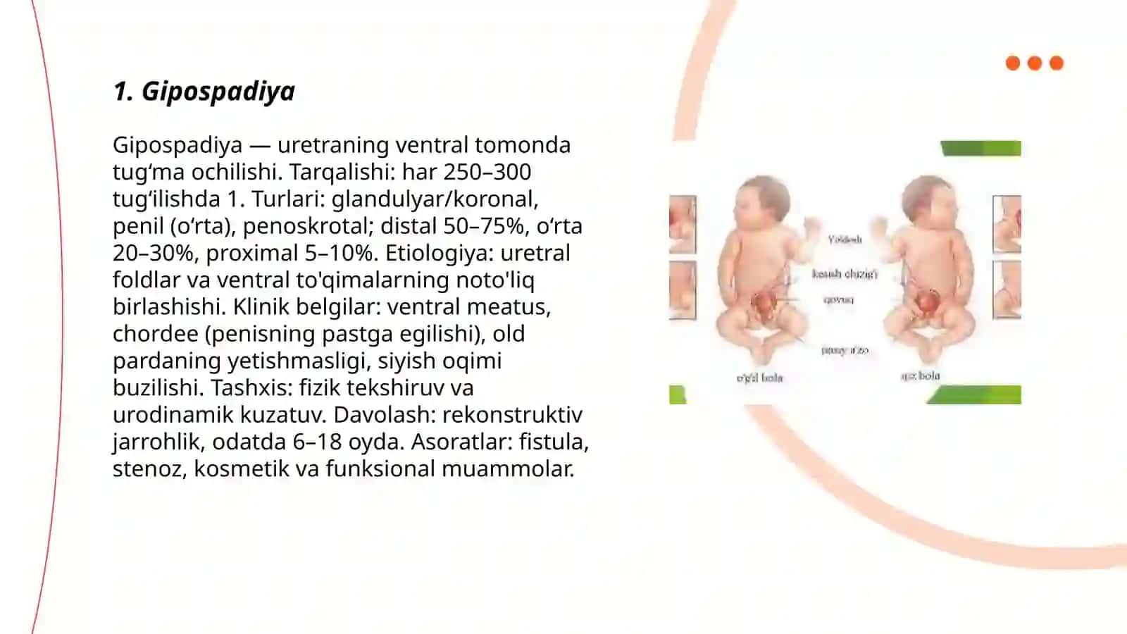 Jinsiy olat tug‘ma rivojlanish nuqsonlari 3